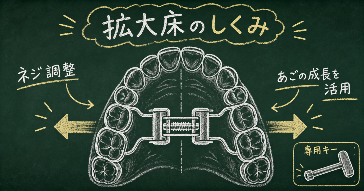 床矯正の拡大床は痛い？あごを広げる仕組みとネジ調整を医師が解説